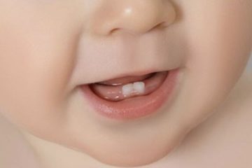 Développement maxillo-facial de l'enfant